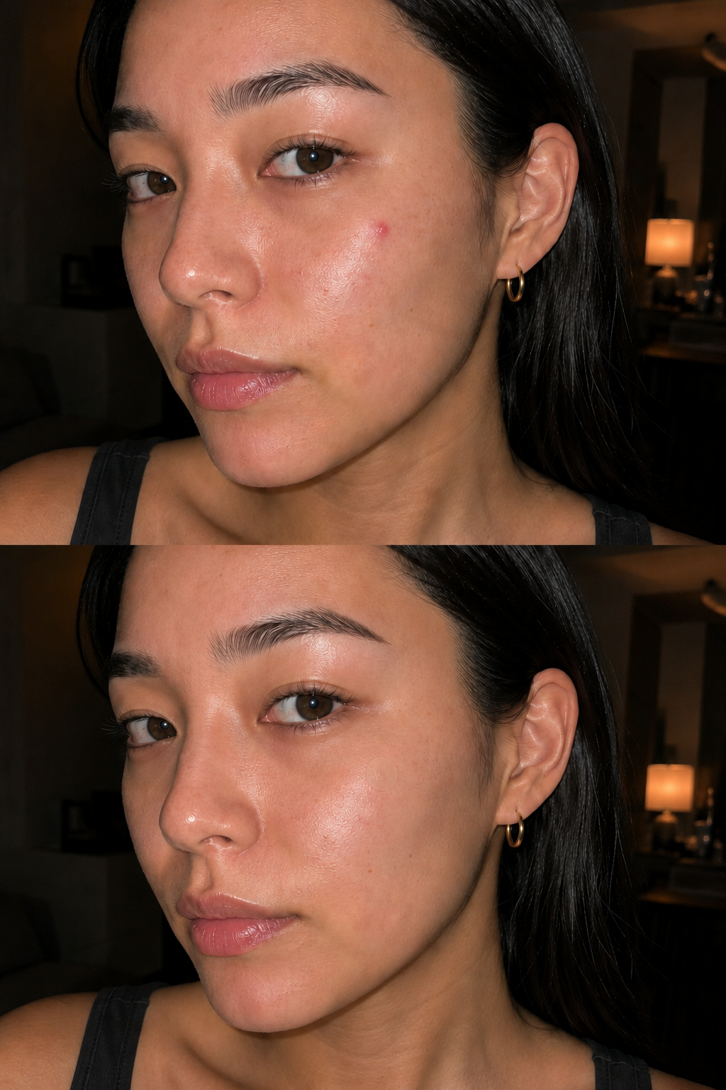 A cheek blemish before applying a patch