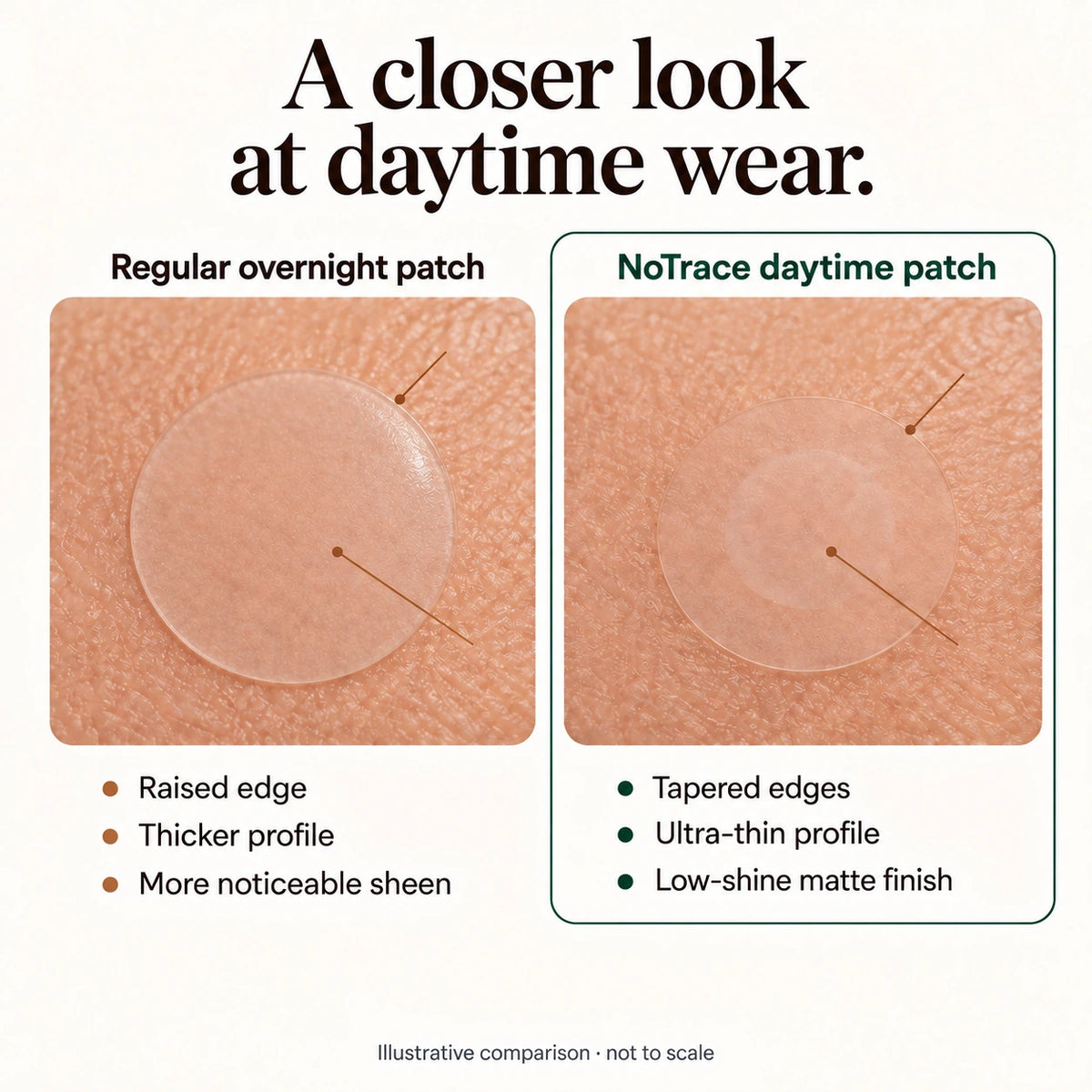 Illustrative comparison of a normal overnight patch and NoTrace's thin tapered edges and matte finish