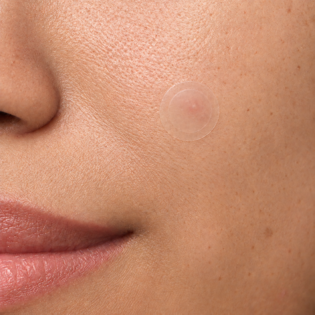 Routine illustration showing the close-up appearance of a fresh translucent patch on skin.